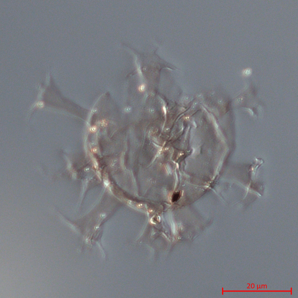 Oligosphaeridium albertense is dinoflagellate cyst species originally described (as Hystrichosphaeridium) in 1962 by Stanley Pocock from wells in Alberta and Saskatchewan. This specimen was recovered from a core in the Albian (Lower Cretaceous) Skull Creek Member of the Ashville Formation, Manitoba, Canada.